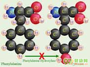苯丙酮尿症